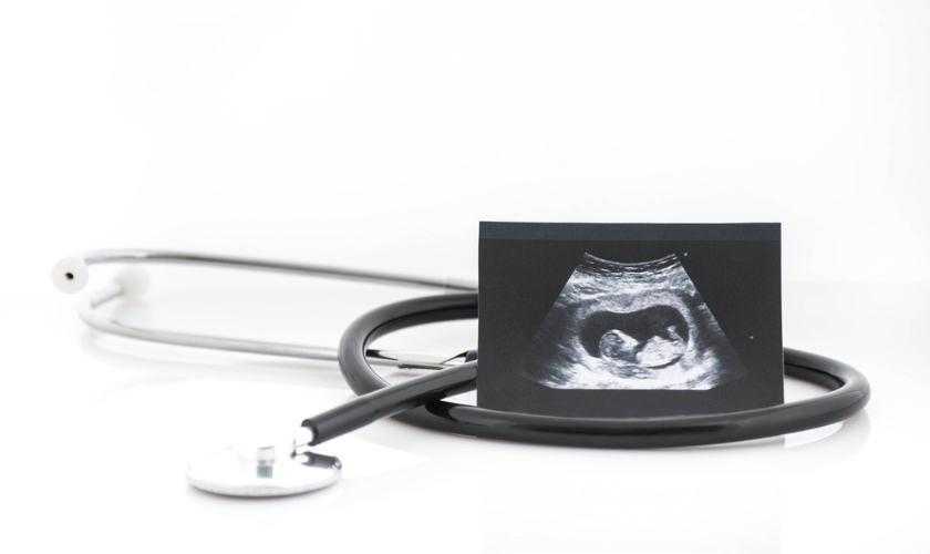 A photo of a stethescope laying on a table with an ultrasound of a fetus propped up against it_840x500