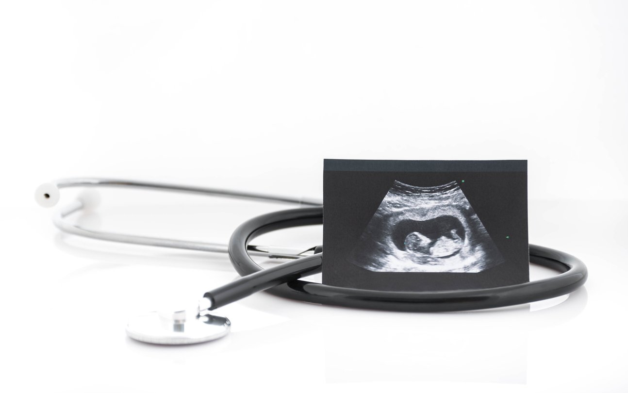 A photo of a stethescope laying on a table with an ultrasound of a fetus propped up against it
